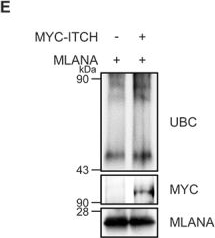 Fig.2.E showing Western Blotting in a Mus musculus (House mouse) sample from the publication: Deciphering melanophagy: role of the PTK2-ITCH-MLANA-OPTN cascade on melanophagy in melanocytes.