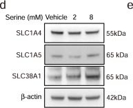 Fig.4.D showing Western Blotting from the publication: Excessive serine from the bone marrow microenvironment impairs megakaryopoiesis and thrombopoiesis in Multiple Myeloma.