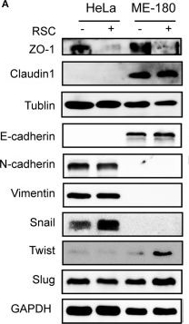 Fig.5.A showing Western Blotting in a Homo sapiens (Human) sample from the publication: Schwann Cell-Derived CCL2 Promotes the Perineural Invasion of Cervical Cancer.