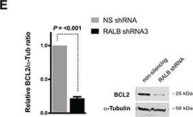 Fig.4.E showing Western Blotting from the publication: RALB provides critical survival signals downstream of Ras in acute myeloid leukemia.