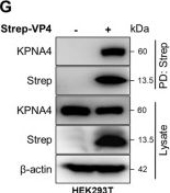 Fig.1.G showing Western Blotting from the publication: Foot-and-mouth disease virus VP4 interferes with host interferon response by targeting the nuclear translocation of interferon regulatory factor 3 (IRF3).