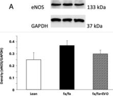 Fig.4.A showing Western Blotting from the publication: Evolocumab Reduces Oxidative Stress and Lipid Peroxidation in Obese Zucker Rats.