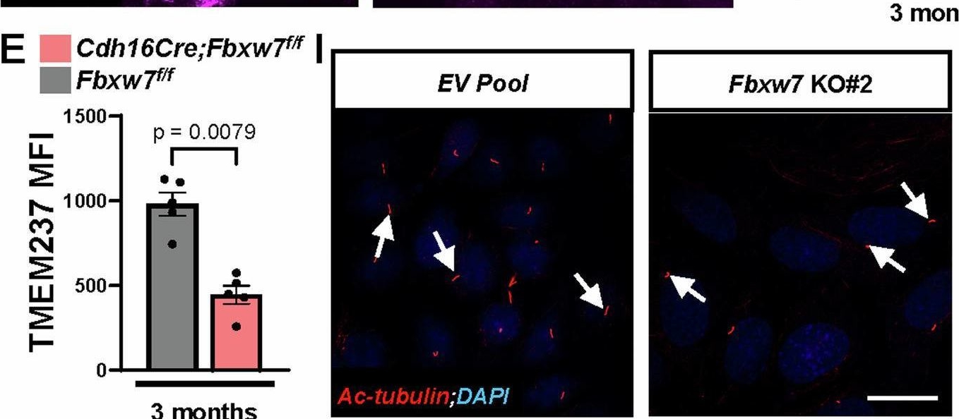 Fig.5.E showing Immunohistochemistry-immunofluorescence in a Mus musculus (House mouse) sample from the publication: SOX9-dependent fibrosis drives renal function in nephronophthisis.