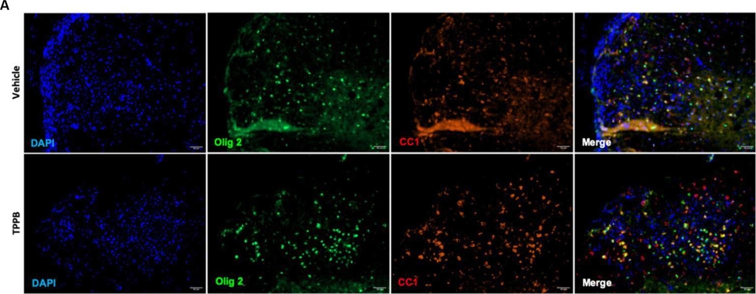 Fig.5.A from the publication: TPPB modulates PKC activity to attenuate neuroinflammation and ameliorate experimental multiple sclerosis.