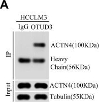 Fig.5.A showing Western Blotting from the publication: The deubiquitinase OTUD3 stabilizes ACTN4 to drive growth and metastasis of hepatocellular carcinoma.
