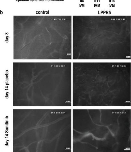 Fig.5.B showing Immunocytochemistry-immunofluorescence from the publication: LPPR5 Expression in Glioma Affects Growth, Vascular Architecture, and Sunitinib Resistance.