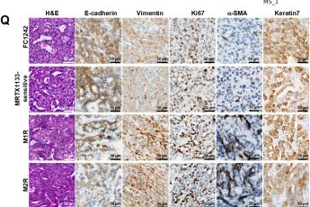 Fig.1.Q showing Immunohistochemistry from the publication: Transcriptional and Epigenetic Plasticity Drive an Alternative Non-clonal Mechanism of Resistance to Kras G12D Inhibition in Pancreatic Cancer.