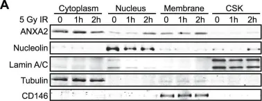 Fig.2.A showing Western Blotting in a Homo sapiens (Human) sample from the publication: Genotoxic agents promote the nuclear accumulation of annexin A2: role of annexin A2 in mitigating DNA damage.
