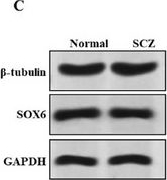 Fig.3.C showing Western Blotting in a Homo sapiens (Human) sample from the publication: KEAP1-NRF2/HO-1 Pathway Promotes Ferroptosis and Neuronal Injury in Schizophrenia.