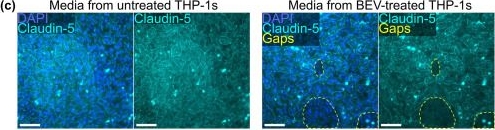Fig.5.C showing Immunohistochemistry-immunofluorescence in a Homo sapiens (Human) sample from the publication: Bacterial extracellular vesicles indirectly destabilize a human stem cell-derived blood-brain barrier on-chip through pro-inflammatory stimulation of immune cells.