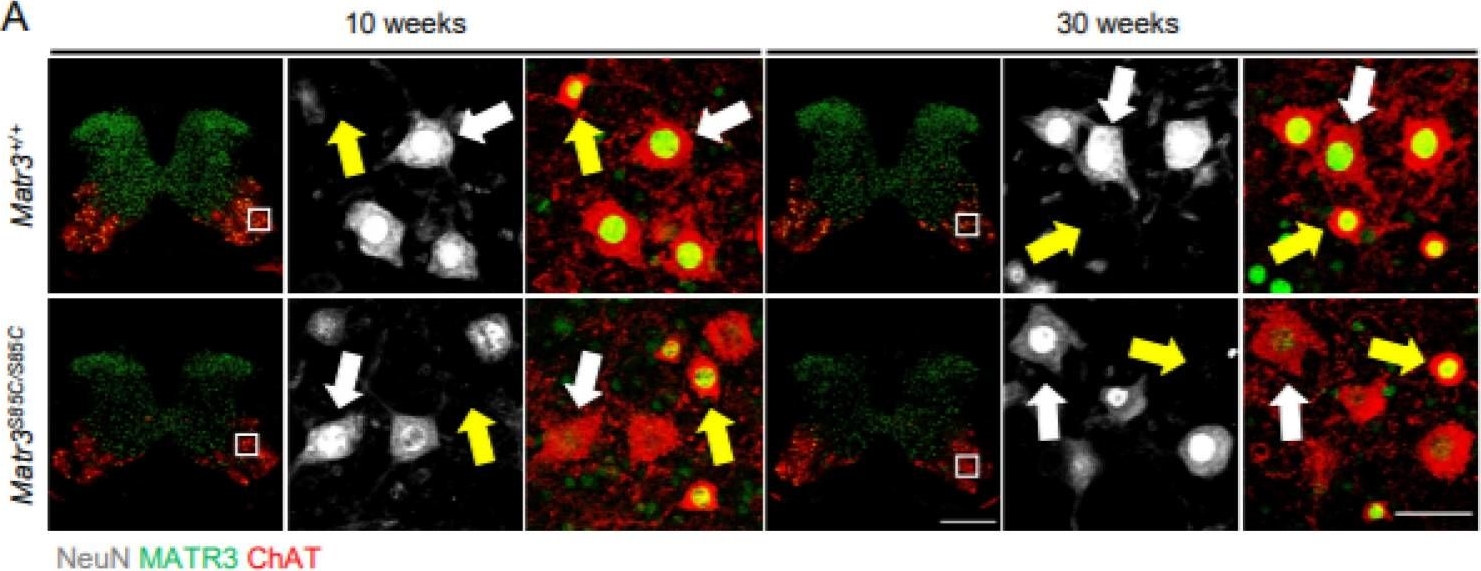 Fig.1.A showing Immunohistochemistry-immunofluorescence in a Mus musculus (House mouse) sample from the publication: Selective Loss of MATR3 in Spinal Interneurons, Upper Motor Neurons and Hippocampal CA1 Neurons in a MATR3 S85C Knock-In Mouse Model of Amyotrophic Lateral Sclerosis.