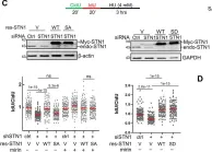 Fig.2.C showing Western Blotting from the publication: CaMKK2 and CHK1 phosphorylate human STN1 in response to replication stress to protect stalled forks from aberrant resection.