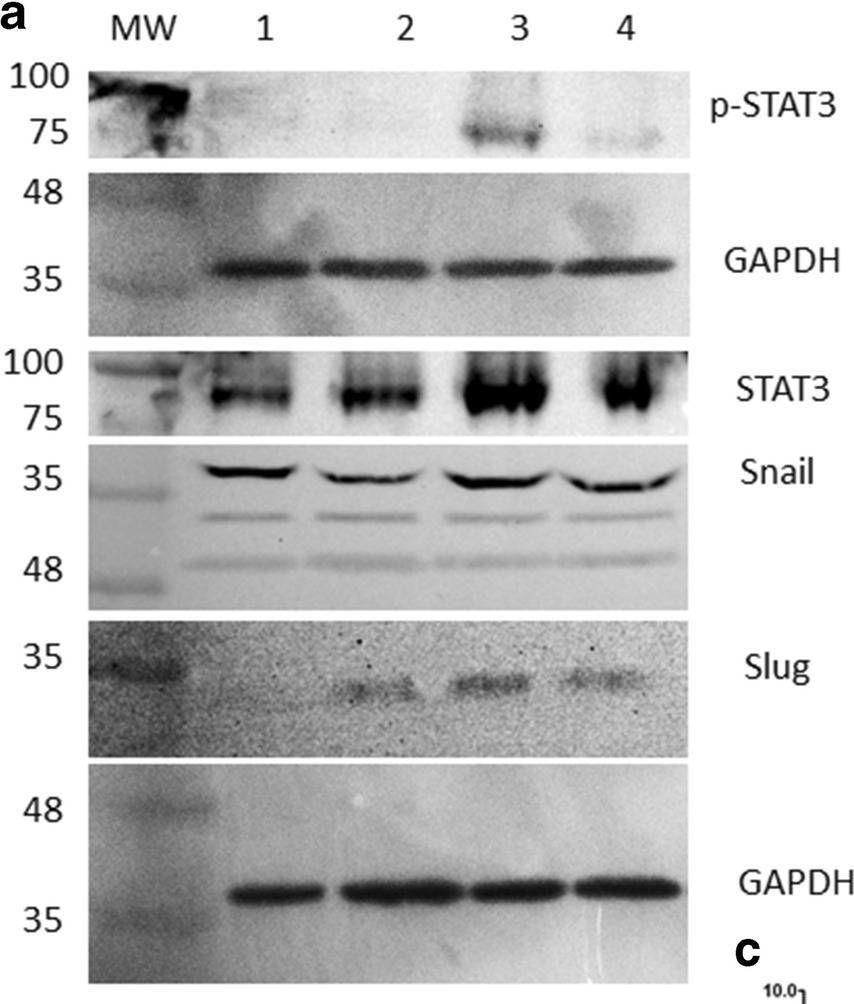 Fig.6.A showing Western Blotting from the publication: Pleiotropic Effects of Epithelial Mesenchymal Crosstalk on Head and Neck Cancer: EMT and beyond.