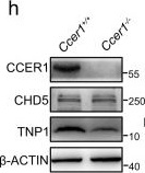 Fig.7.H showing Western Blotting in a Mus musculus (House mouse) sample from the publication: Phase-separated CCER1 coordinates the histone-to-protamine transition and male fertility.