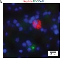 Fig.2.D showing Immunohistochemistry-immunofluorescence in a Mus musculus (House mouse) sample from the publication: Adult Mouse Kidney Stem Cells Orchestrate the De Novo Assembly of a Nephron via Sirt2-Modulated Canonical Wnt/β-Catenin Signaling.