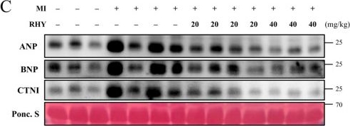 Fig.2.C showing Western Blotting from the publication: Rhynchophylline Protects Against Ischemic Injury Following Myocardial Infarction via Activation of the SIRT1/NRF2/FOXO3a Axis.