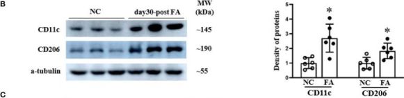 CD11c (D1V9Y) Rabbit Monoclonal Antibody | Cell Signaling Technology CD11c (D1V9Y) Rabbit Monoclonal Antibody | Cell Signaling Technology