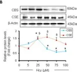 Fig.1.B showing Western Blotting in a Mus musculus (House mouse) sample from the publication: H2S and homocysteine control a novel feedback regulation of cystathionine beta synthase and cystathionine gamma lyase in cardiomyocytes.