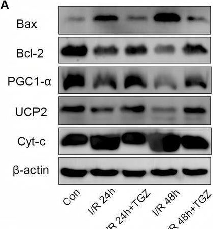 Fig.9.A showing Western Blotting from the publication: Integrating Multi-Omics Data Using Machine Learning to Explore New Therapeutic Targets for Acute Kidney Injury.