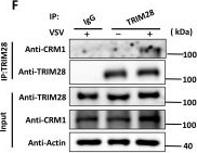 Fig.6.F showing Western Blotting from the publication: CRM1-dependent nuclear export of TRIM28 promotes MAVS K48-linked ubiquitination and suppresses RIG-I-mediated antiviral response.
