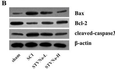 Fig.3.B showing Western Blotting in a Rattus norvegicus (Rat) sample from the publication: Isosteviol Sodium Promotes Neurological Function Recovery in a Model of Spinal Cord Injury in Rats.