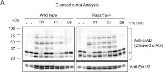 Fig.9.A showing Western Blotting from the publication: The tumor suppressor gene, RASSF1A, is essential for protection against inflammation -induced injury.