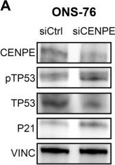 Fig.7.A showing Western Blotting in a Homo sapiens (Human) sample from the publication: CENPE Inhibition Leads to Mitotic Catastrophe and DNA Damage in Medulloblastoma Cells.
