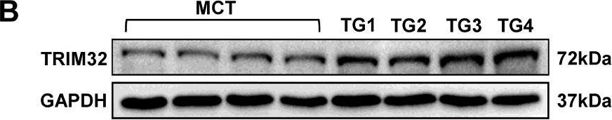 Fig.3.B showing Western Blotting in a Mus musculus (House mouse) sample from the publication: Tripartite motif 32 prevents pathological cardiac hypertrophy.