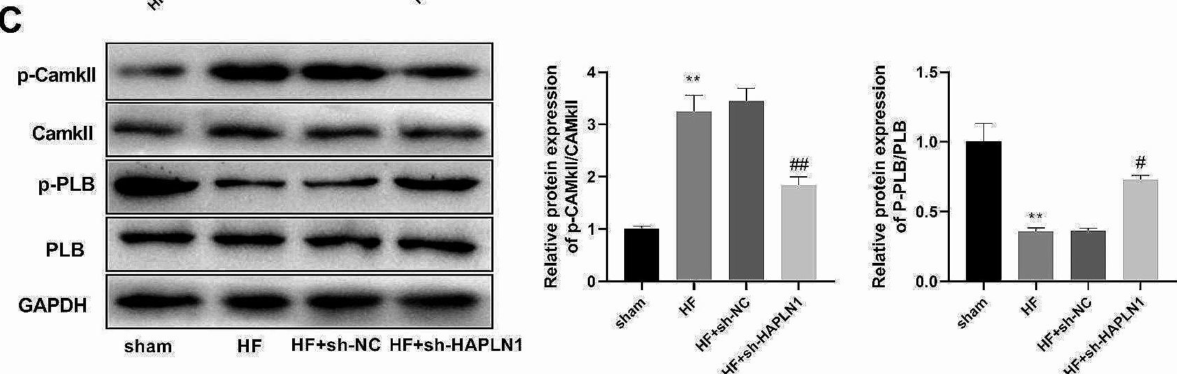 Fig.8.C showing Western Blotting in a Homo sapiens (Human) sample from the publication: HAPLN1 knockdown inhibits heart failure development via activating the PKA signaling pathway.