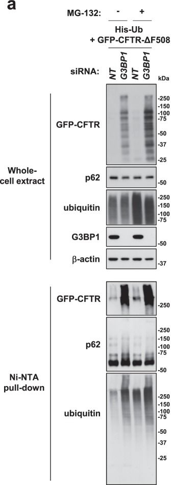 G3BP1 inhibits ubiquitinated protein aggregations induced by p62 and USP10.
