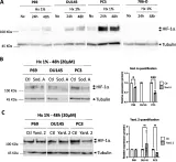 Fig.2.A,B,C showing Western Blotting in a Homo sapiens (Human) sample from the publication: The marine-derived HIF-1α inhibitor, Yardenone 2, reduces prostate cancer cell proliferation by targeting HIF-1 target genes.