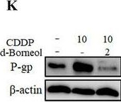 Fig.1.K showing Western Blotting in a Homo sapiens (Human) sample from the publication: d-Borneol enhances cisplatin sensitivity via p21/p27-mediated S-phase arrest and cell apoptosis in non-small cell lung cancer cells and a murine xenograft model.