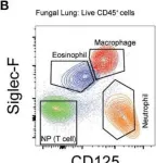 Fig.2.B showing Flow cytometry/Cell sorting from the publication: STAT6 Blockade Abrogates Aspergillus-Induced Eosinophilic Chronic Rhinosinusitis and Asthma, A Model of Unified Airway Disease.