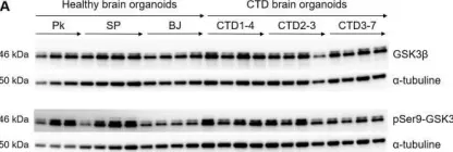 Fig.6.A showing Western Blotting from the publication: Deciphering neuronal deficit and protein profile changes in human brain organoids from patients with creatine transporter deficiency.