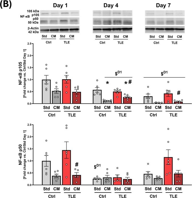 Fig.8.B showing Western Blotting from the publication: Cytoprotective and Immunomodulatory Properties of Mesenchymal Stem Cell Secretome and Its Effect on Organotypic Hippocampal Cultures in Mouse Model of Temporal Lobe Epilepsy.