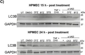 Fig.2.C showing Western Blotting in a Homo sapiens (Human) sample from the publication: Proteasomal inhibition compromises microvascular integrity via distinct effects on non-immune endothelial cells and immune cells.