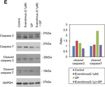 Fig.4.E showing Western Blotting from the publication: Inhibitory effects of the combination of rapamycin with gemcitabine plus paclitaxel on the growth of pancreatic cancer tumors.