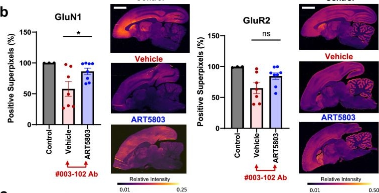 Fig.6.B showing Immunohistochemistry-immunofluorescence from the publication: Monoclonal humanized monovalent antibody blocking therapy for anti-NMDA receptor encephalitis.