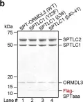 Fig.6.B showing Western Blotting from the publication: Ceramide sensing by human SPT-ORMDL complex for establishing sphingolipid homeostasis.