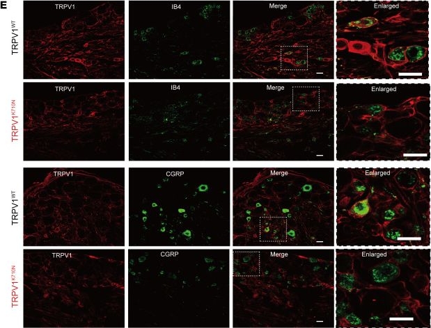 Fig.4.E showing Immunohistochemistry-immunofluorescence in a Mus musculus (House mouse) sample from the publication: A human TRPV1 genetic variant within the channel gating domain regulates pain sensitivity in rodents.