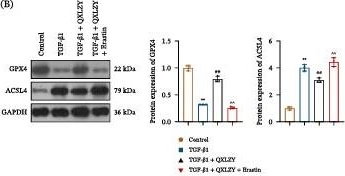 Fig.7.B showing Western Blotting from the publication: Qingxin Lianzi Yin Improves Chronic Kidney Disease by Targeting Ferroptosis via the TLR4/HIF-1α Pathway.