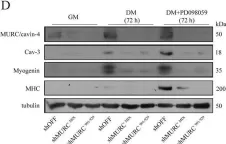Fig.6.D showing Western Blotting from the publication: MURC/cavin-4 Is Co-Expressed with Caveolin-3 in Rhabdomyosarcoma Tumors and Its Silencing Prevents Myogenic Differentiation in the Human Embryonal RD Cell Line.