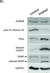 Fig.6.B showing Western Blotting from the publication: Aurora B kinase is a potent and selective target in MYCN-driven neuroblastoma.