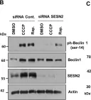 Fig.5.B showing Western Blotting in a Homo sapiens (Human) sample from the publication: SESN2 facilitates mitophagy by helping Parkin translocation through ULK1 mediated Beclin1 phosphorylation.