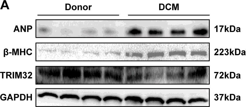 Fig.1.A showing Western Blotting in a Homo sapiens (Human) sample from the publication: Tripartite motif 32 prevents pathological cardiac hypertrophy.
