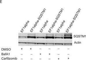 Hydroxychloroquine potentiates carfilzomib toxicity towards myeloma cells.
