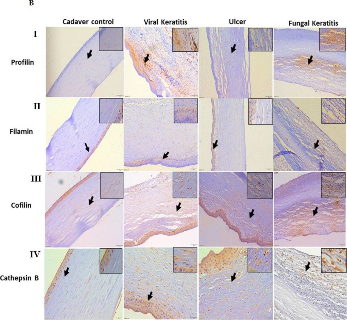 Fig.5.B showing Immunohistochemistry from the publication: Quantitative Proteomics Reveals Molecular Network Driving Stromal Cell Differentiation: Implications for Corneal Wound Healing.