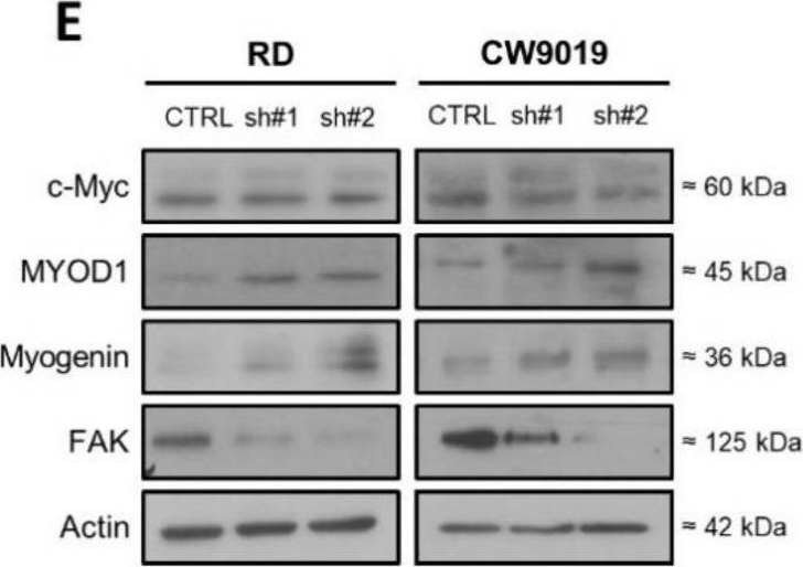 Fig.2.E showing Western Blotting from the publication: Dickkopf-1 Inhibition Reactivates Wnt/β-Catenin Signaling in Rhabdomyosarcoma, Induces Myogenic Markers In Vitro and Impairs Tumor Cell Survival In Vivo.
