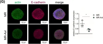 Fig.2.G showing Immunocytochemistry-immunofluorescence from the publication: Tumor-Extrinsic Axl Expression Shapes an Inflammatory Microenvironment Independent of Tumor Cell Promoting Axl Signaling in Hepatocellular Carcinoma.