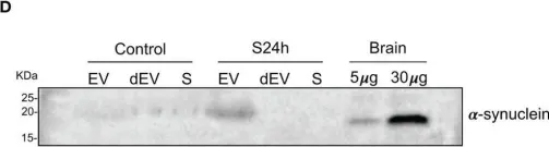 Fig.4.D showing Western Blotting from the publication: Surgical Trauma in Mice Modifies the Content of Circulating Extracellular Vesicles.